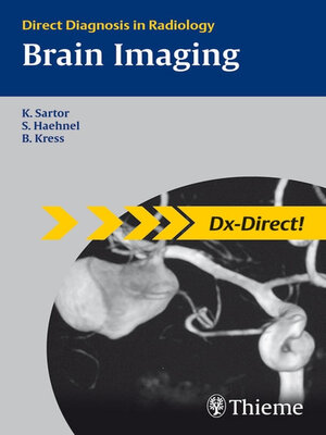 cover image of Brain Imaging